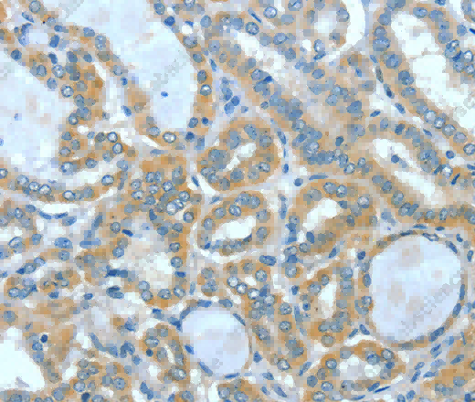 SPHK2 Polyclonal Antibody - 2