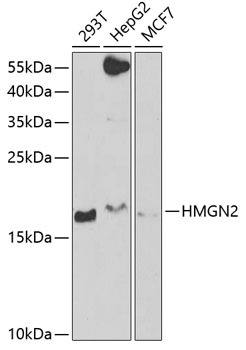 Western blot analysis of extracts of various cell lines using HMGN2 Polyclonal Antibody at 1:1000 dilution.