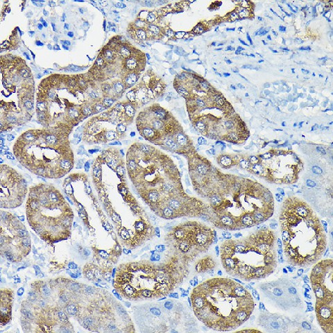 Immunohistochemistry of paraffin-embedded mouse kidney using Nesprin 1 Polyclonal Antibody at dilution of 1:100 (40x lens).Perform high pressure antigen retrieval with 10 mM citrate buffer pH 6.0 before commencing with IHC staining protocol.