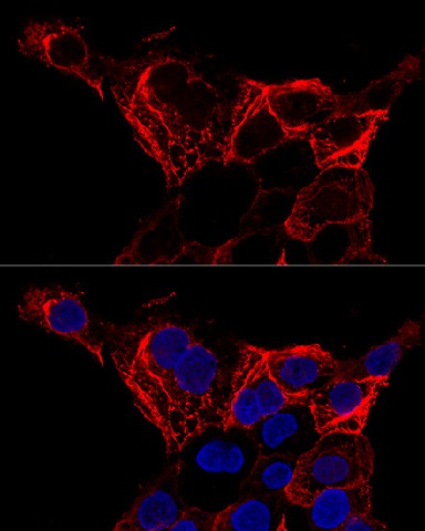 Confocal immunofluorescence analysis of A-431 cells using KRT20 Polyclonal Antibody at dilution of 1:200. Blue: DAPI for nuclear staining.