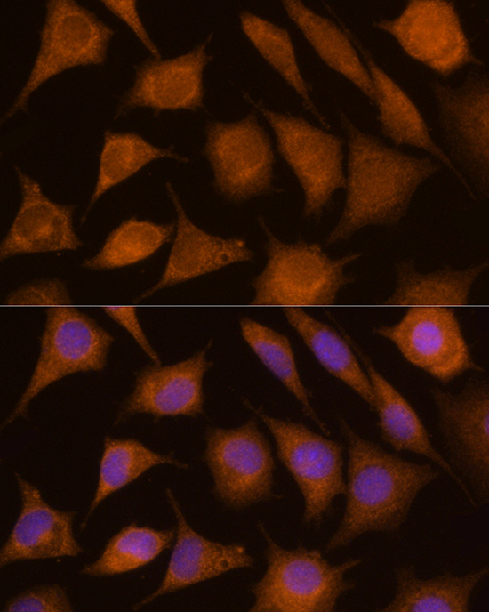 Immunofluorescence analysis of L929 using CTSC Polyclonal Antibody at dilution of 1:100 (40x lens). Blue: DAPI for nuclear staining.