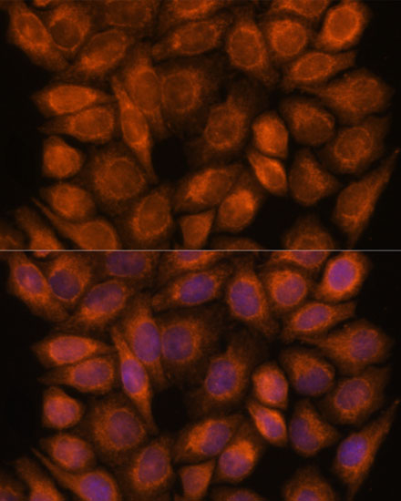 Immunofluorescence analysis of HeLa cells using SNX15 Polyclonal Antibody at dilution of  1:100. Blue: DAPI for nuclear staining.