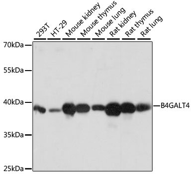 Western blot analysis of extracts of various cell lines using B4GALT4 Polyclonal Antibody at 1:1000 dilution.
