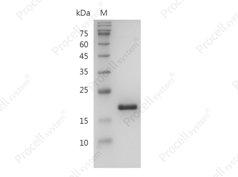 IL-1RA/ICIL-1RA/IRAP/IL-1RN, Human, Recombinant