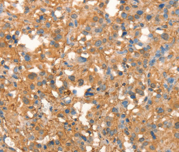 CRELD1 Polyclonal Antibody - 2