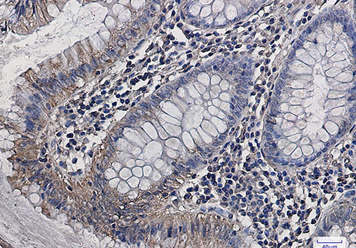 Recombinant GOT2 Monoclonal Antibody - 2