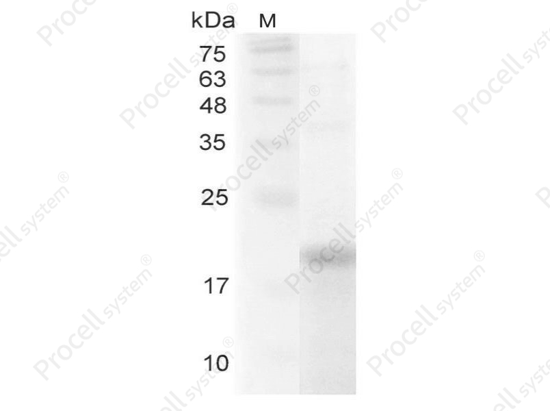IL-32&alpha;/NK4/TAIF, Human, Recombinant
