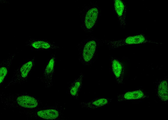 RPRD1B Monoclonal Antibody-searchlist-1