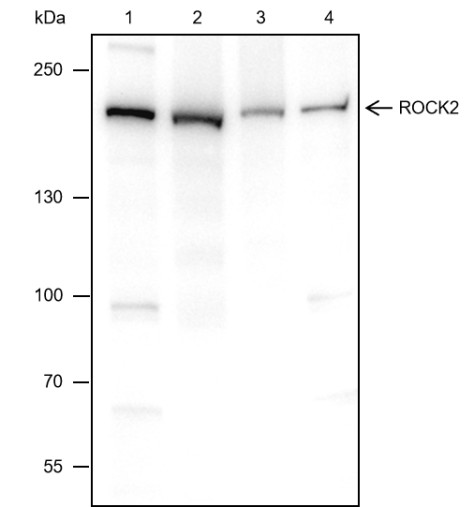 Recombinant ROCK2 Monoclonal Antibody - small - 2
