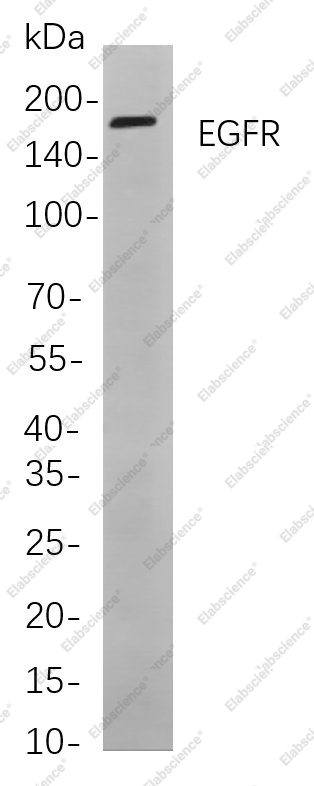 Recombinant EGFR Monoclonal Antibody - 1