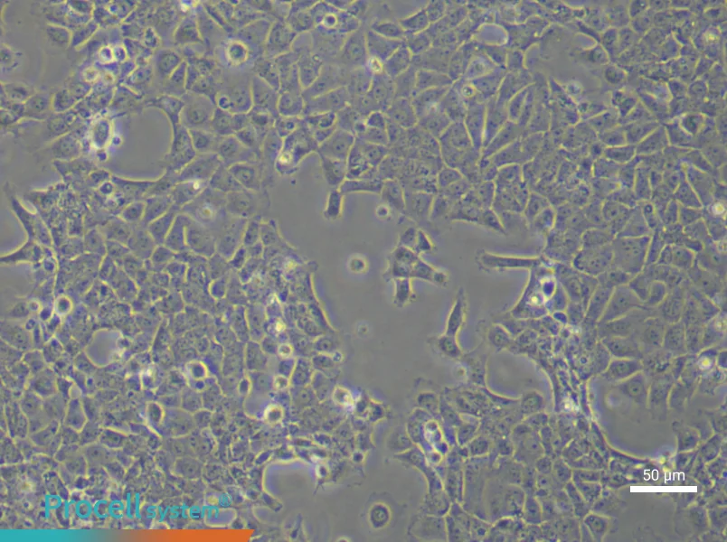 Rat Cardiac Fibroblasts (Primary cell immortalization)Rat Cardiac Fibroblasts (Primary cell immortalization) - 5