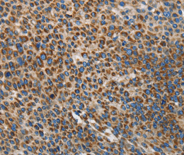 UPF1 Polyclonal Antibody - 2