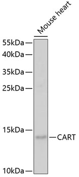 Western blot analysis of extracts of mouse heart using CART Polyclonal Antibody at 1:1000 dilution.