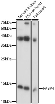 Western blot analysis of extracts of various cell lines using FABP4 Polyclonal Antibody at 1:1000 dilution.