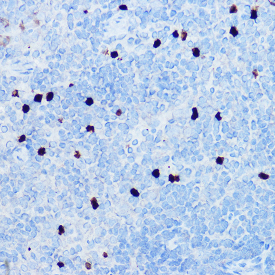 Immunohistochemistry of paraffin-embedded mouse spleen using S100A8 Polyclonal Antibody at dilution of 1:50 (40x lens).Perform high pressure antigen retrieval with 10 mM citrate buffer pH 6.0 before commencing with IHC staining protocol.