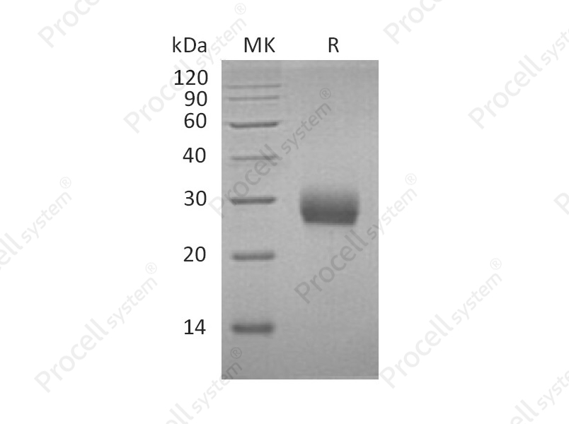 RANK/TNFRSF11A/CD265 (C-6His), Mouse, Recombinant