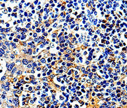 Immunohistochemistry of paraffin-embedded Human tonsil tissue using COX16 Polyclonal Antibody at dilution 1:50