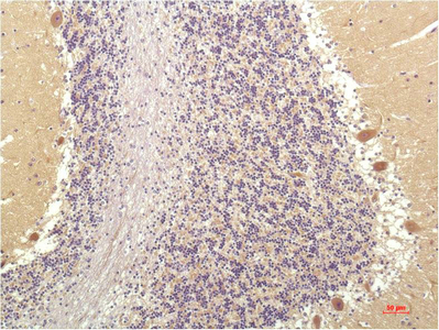 Immunohistochemistry of paraffin-embedded Human brain tissue using SGK1 Monoclonal Antibody at dilution of 1:200.