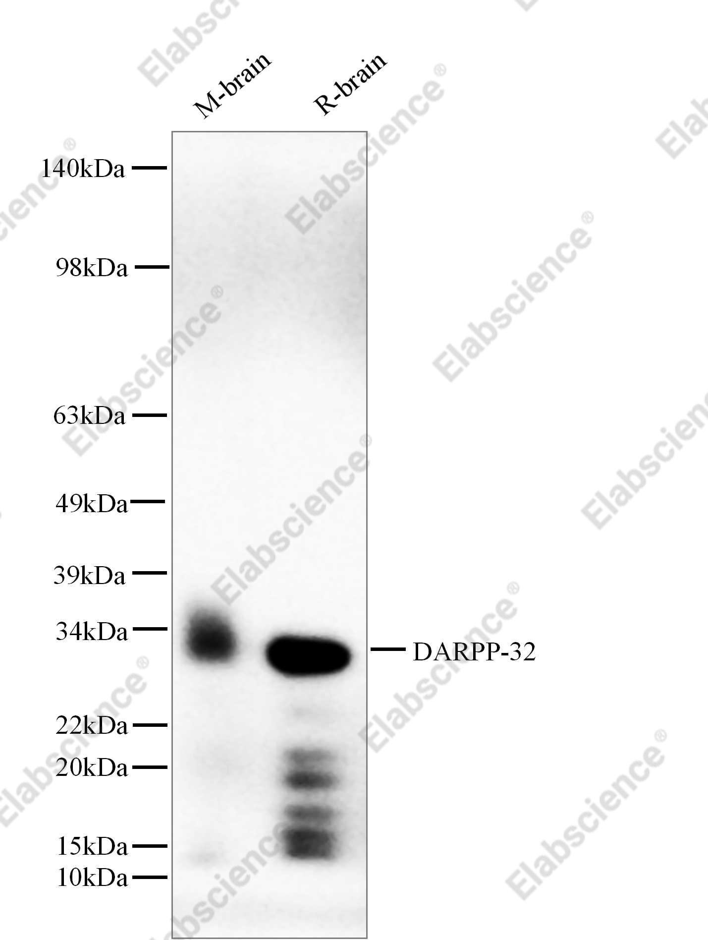 Recombinant DARPP-32 Monoclonal Antibody - 1