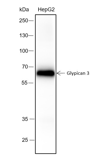 Recombinant Glypican 3 Monoclonal Antibody-searchlist-1
