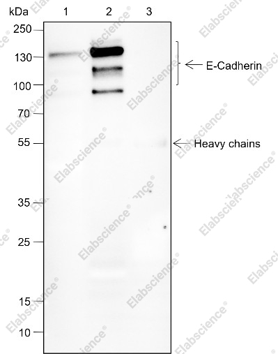 Recombinant E-Cadherin Monoclonal Antibody - 3