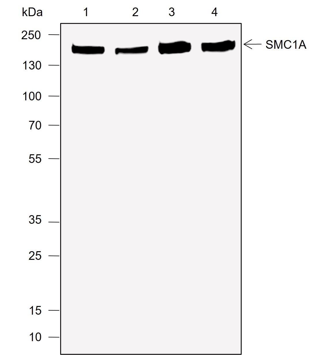 Recombinant SMC1A Monoclonal Antibody-searchlist-1