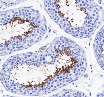Recombinant AKAP4 Monoclonal Antibody-searchlist-3