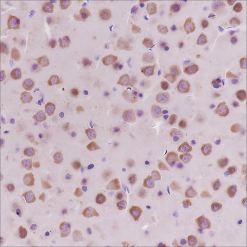 Recombinant Dynamin 1 Monoclonal Antibody - small - 3