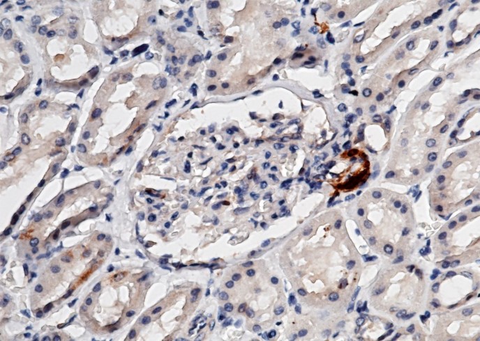 Recombinant Renin/REN/Angiotensinogenase Monoclonal Antibody - 1