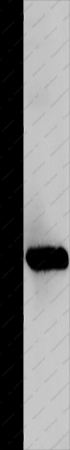 Galectin 1 Polyclonal Antibody - 1