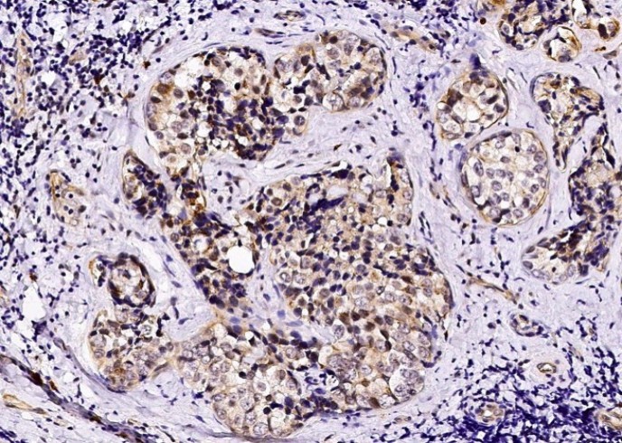 Recombinant PIGR Monoclonal Antibody - small - 3