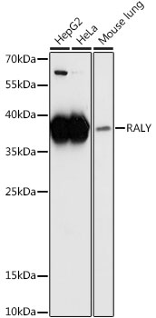 Western blot analysis of extracts of various cell lines using RALY Polyclonal Antibody at 1:1000 dilution.