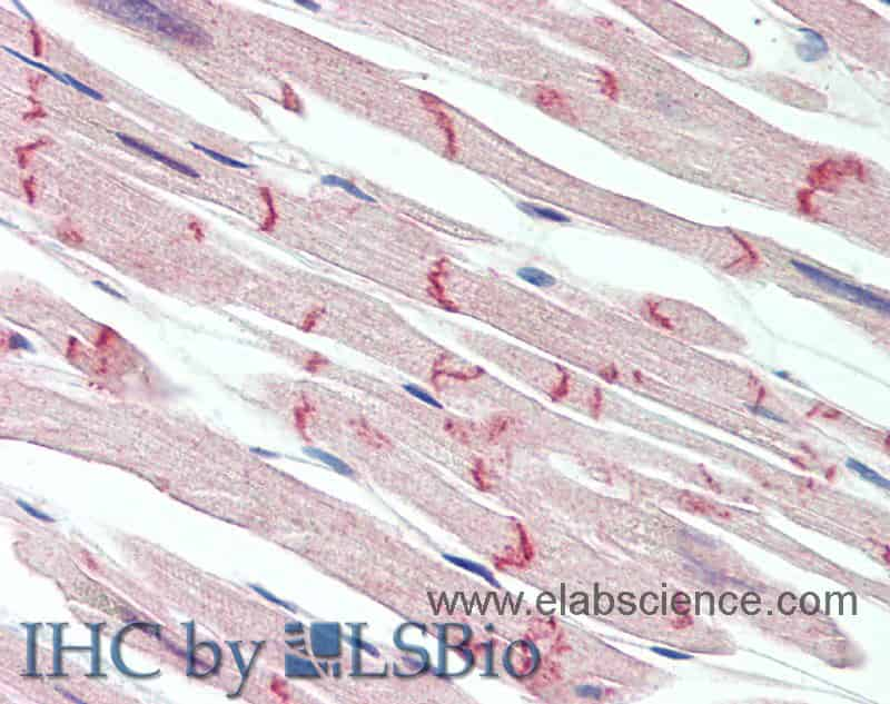 Immunohistochemistry of paraffin-embedded Heart tissue using DSG2 Polyclonal Antibody at dilution of 1:150(Elabscience Product Detected by Lifespan).