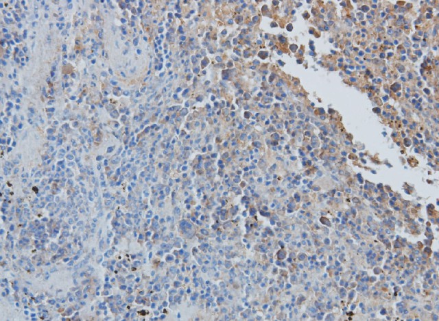 Immunohistochemistry of paraffin-embedded Rat spleen using CCL7 Polyclonal Antibody at dilution of 1:50