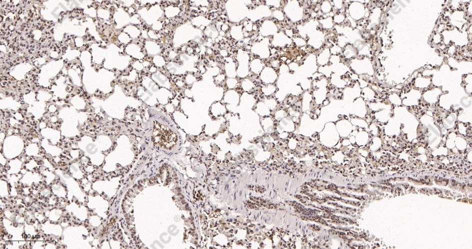 Recombinant ATF-4 Monoclonal Antibody - 2