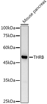 Western blot analysis of extracts of Mouse pancreas using TRβ1/THRB Polyclonal Antibody at 1:1000 dilution.