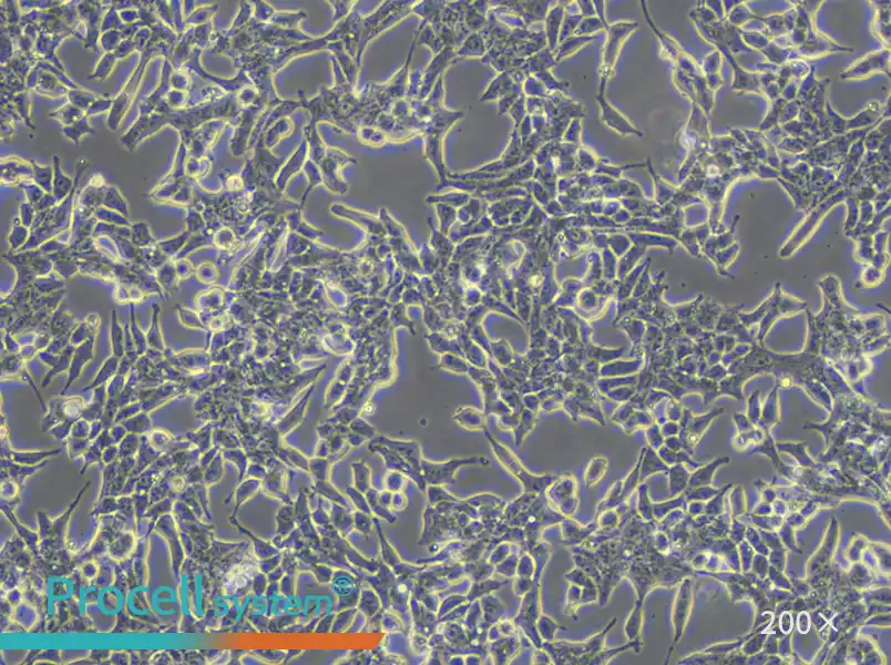22RV1 Cell Complete Medium - small - 4