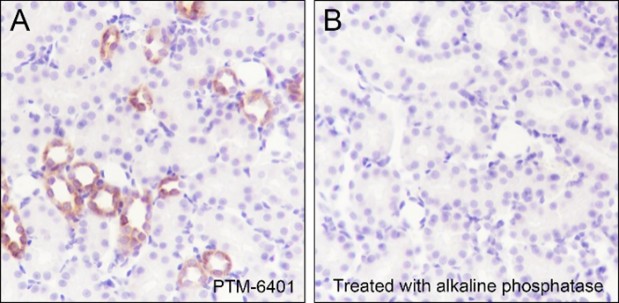 Recombinant Phospho-IKB alpha (Ser32, Ser36) Monoclonal Antibody-searchlist-3
