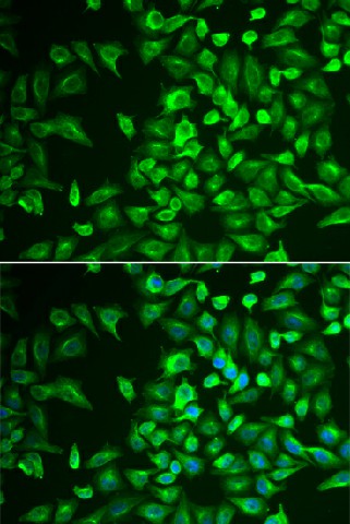 Immunofluorescence analysis of U2OS cells using LRat Polyclonal Antibody