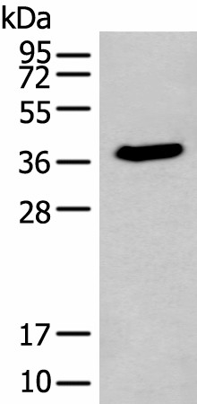 Western blot analysis of HEPG2 cell lysate  using ACBD4 Polyclonal Antibody at dilution of 1:400