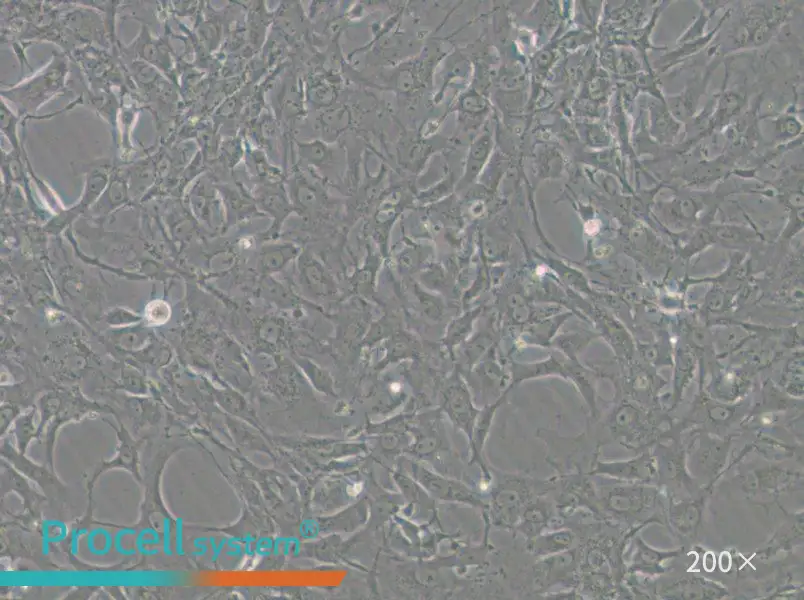 Tb 1 Lu Cell Complete Medium - 6