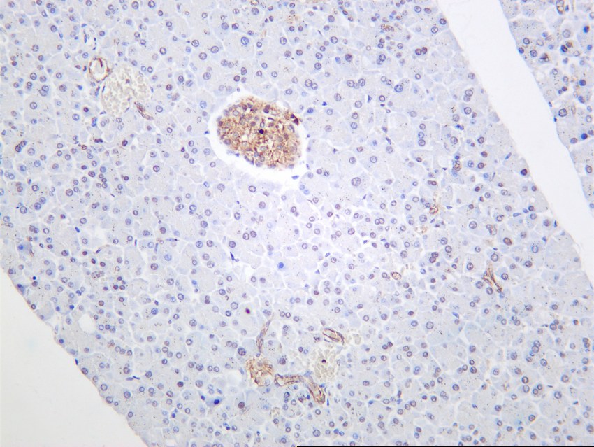 Recombinant TNF α Monoclonal Antibody - 2