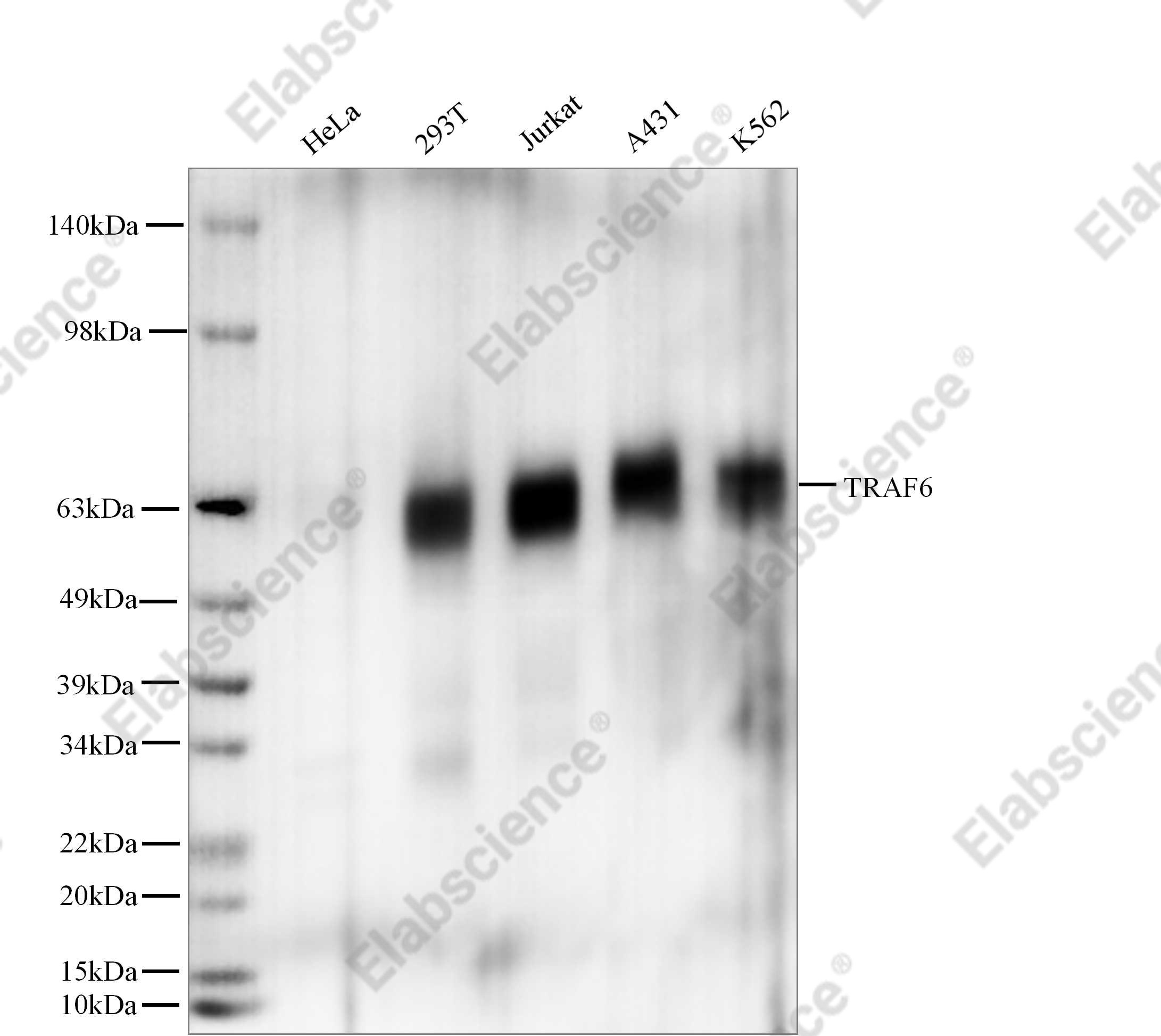 Recombinant TRAF6 Monoclonal Antibody - 1