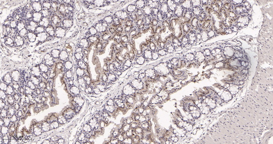 Recombinant CDK6 Monoclonal Antibody - small - 3