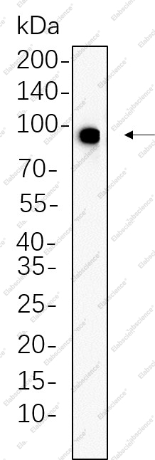 Recombinant Phospho-IGF1R (Tyr1135/1136)/Phospho-Insulin Receptor β (Tyr1150/1151) Monoclonal Antibody - 1