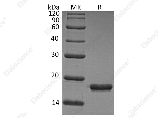 Recombinant Human REG1A/PSPS Protein (His Tag) - 1