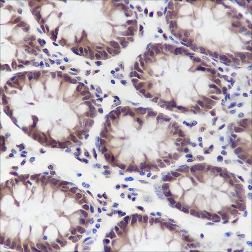 Recombinant DYNLL1 Monoclonal Antibody - 2