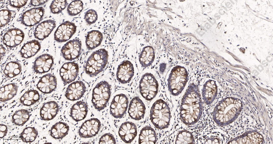 Recombinant UQCRC2 Monoclonal Antibody - 2