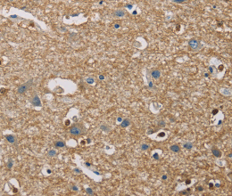 PIP4K2A Polyclonal Antibody - 3