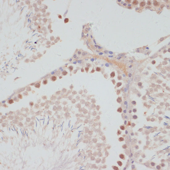 Immunohistochemistry of paraffin-embedded rat testis using Cyclin G1 Polyclonal Antibody at dilution of 1:100 (40x lens).Perform microwave antigen retrieval with 10 mM PBS buffer pH 7.2 before commencing with IHC staining protocol.